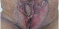 18b